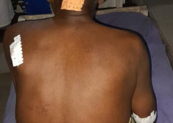 Siguiri : affrontement entre Nabou et BENDOUGOU,le bilan est passé à 38 dont un mort.