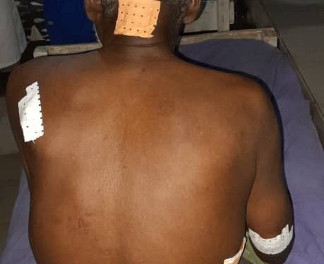 Siguiri : affrontement entre Nabou et BENDOUGOU,le bilan est passé à 38 dont un mort.