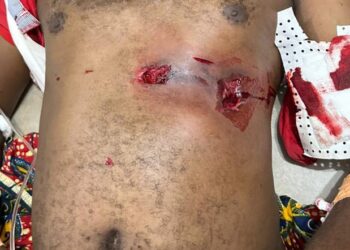 Siguiri : un marchand frolle la mort en face de son domicile