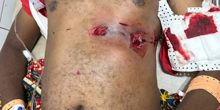 Siguiri : un marchand frolle la mort en face de son domicile