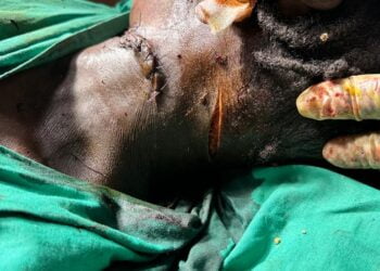 Siguiri : un homme tente de tuer une femme en l&rsquo;egorgeant