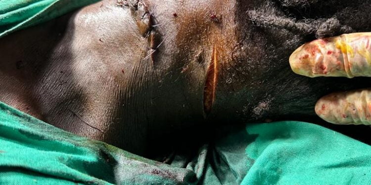 Siguiri : un homme tente de tuer une femme en l’egorgeant