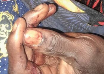 Siguiri : un homme succombe de ses blessures après avoir été poignardé par « son ami »