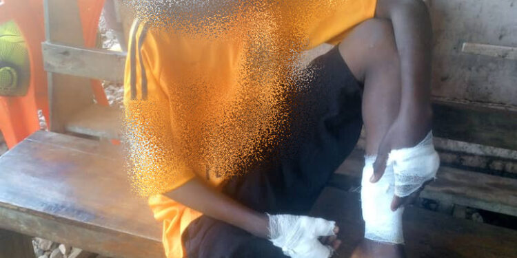 Lèro : Risque de zoonose, après la morsure de 7 personnes par un chien errant. 