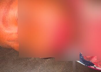 Siguiri : un homme mord sa fille et lui arrache une bonne partie de ses lèvres.